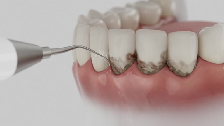 Trusted Wisdom Tooth Removal service in Clara City, MN - Dentist Open Now